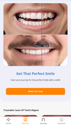 Home screen with aligner tab